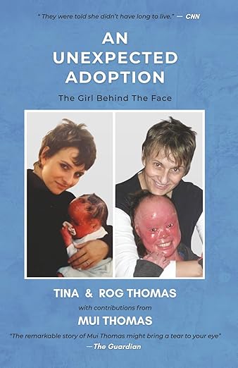 PRE-ORDER: Unexpected Adoption: The Girl Behind the Face